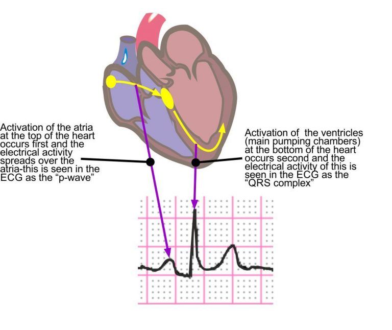 ECG (Electrocardiogram)